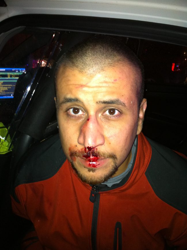 http://www.theamericanconservative.com/wp-content/uploads/2012/12/zimmerman_scene_photo.jpeg