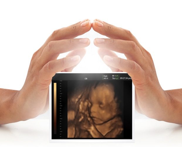 shutterstock_152867303