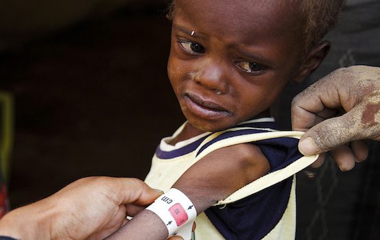 14 Million Yemenis Are at Risk of Dying in Man-Made Famine