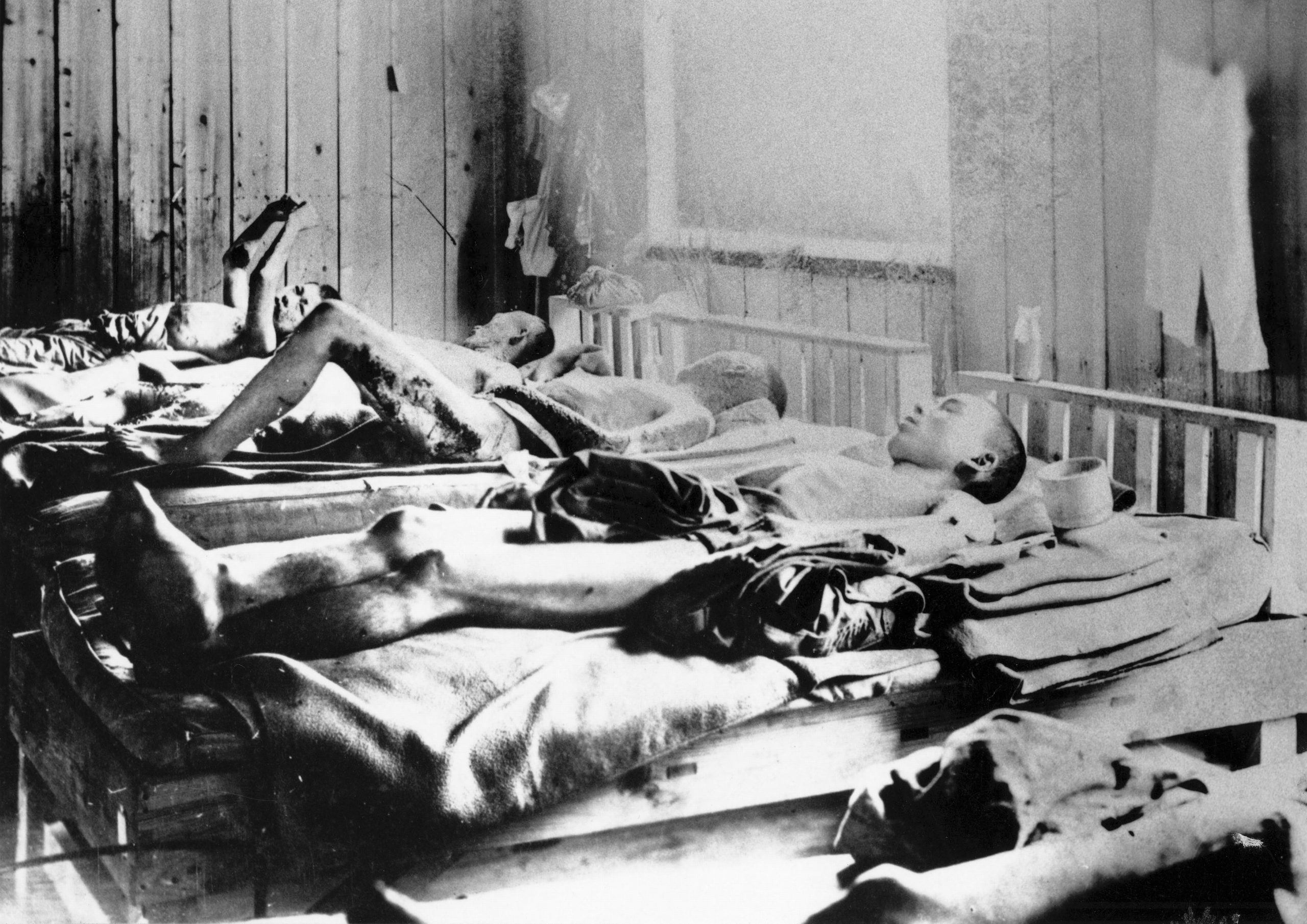 Survivors of the explosion of the Atom bomb at Hiroshima 1945 suffering the effects of radiation. ICRC photograph.