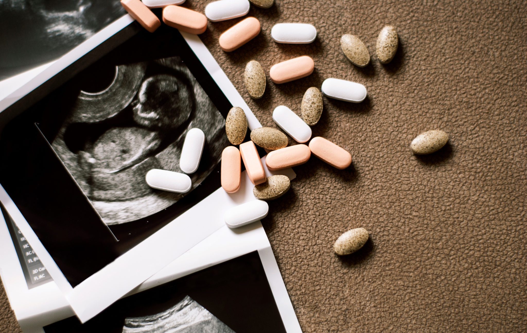 Photo,Of,The,Fetus,On,An,Ultrasound,Scan,And,Few